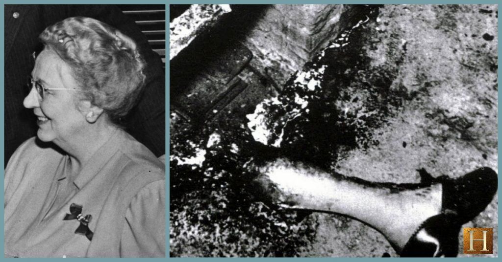 Mary Reeser (L) and a portion of her remaining leg (R).