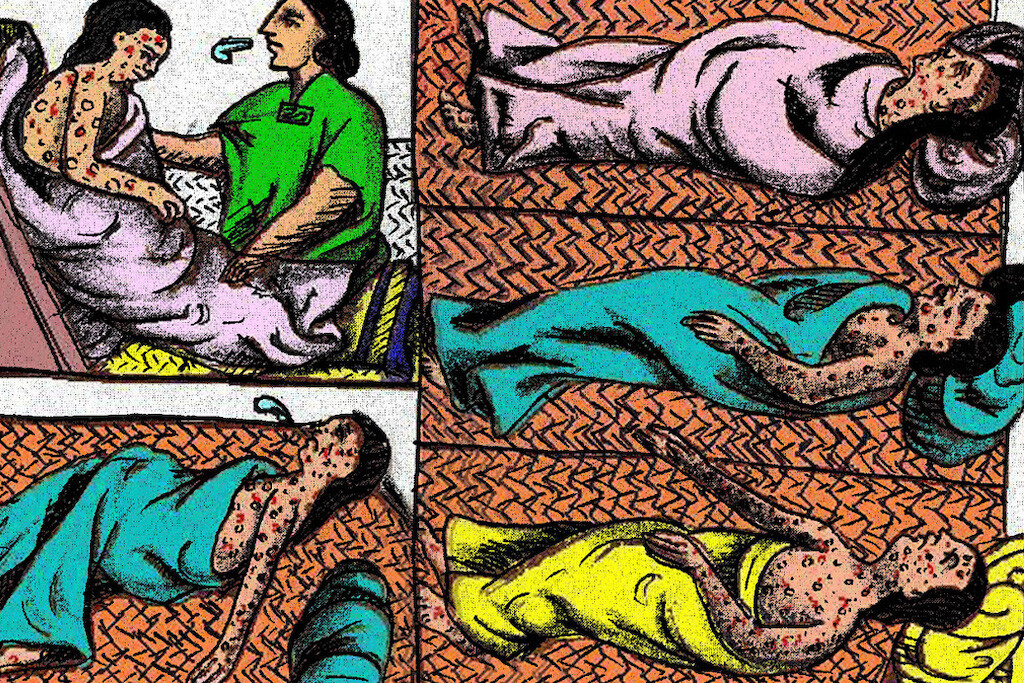 Florentine Codex depicting the smallpox infections in Mexico during the 16th century.
