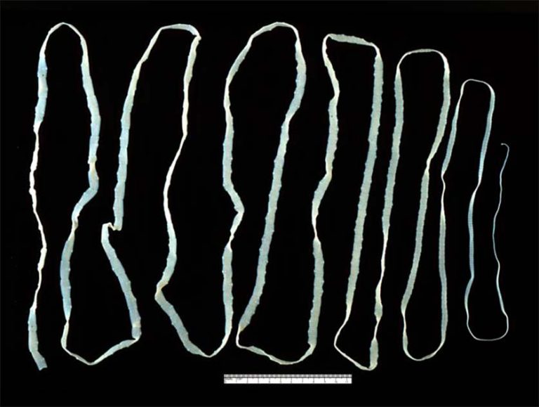The Victorian Tapeworm Diet Be The Host With The Most Historic Mysteries